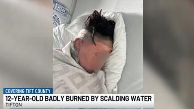 12-Year-Old Georgia Boy Suffers Severe Burns After 3 Friends Pour Boiling Water on Him During Sleepover 'Prank'