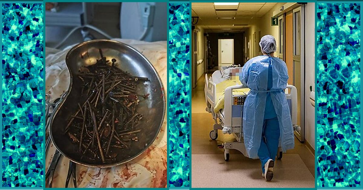 Lithuanian man has over 2 pounds of nails, screws, nuts, and knives surgically removed from stomach