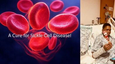 New York patient receives breakthrough cure for sickle cell disease, 'I’m not in pain anymore’