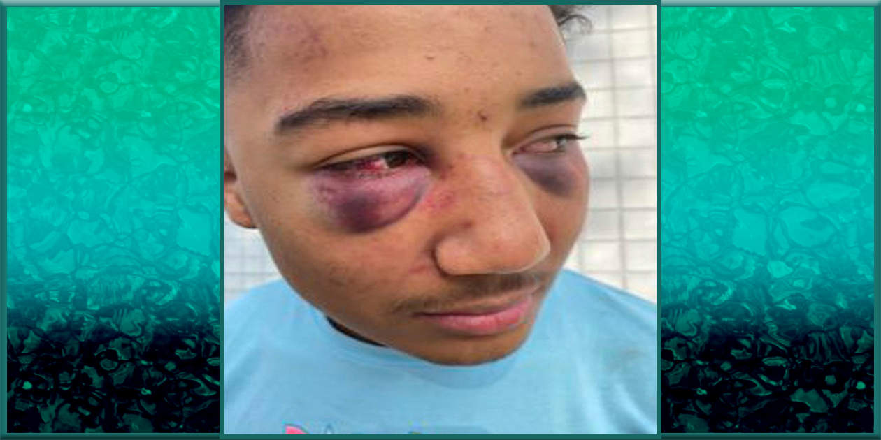Lawsuit: Police 'viciously' beat black teen pulled over for speeding