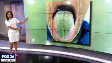 A news anchor stands next to a screen displaying a close-up photo of a green hairy tongue, possibly related to a recent Ohio green hairy tongue case. The image highlights a medical report about hairy tongue after antibiotics.