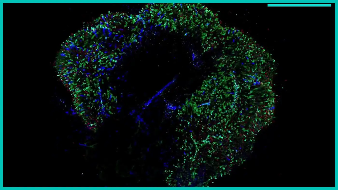 Teal-framed fluorescence image of glowing retinal cells from a gene therapy screening video