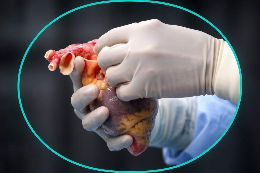 Gloved hands holding a human heart inside a bright teal oval during transplant surgery
